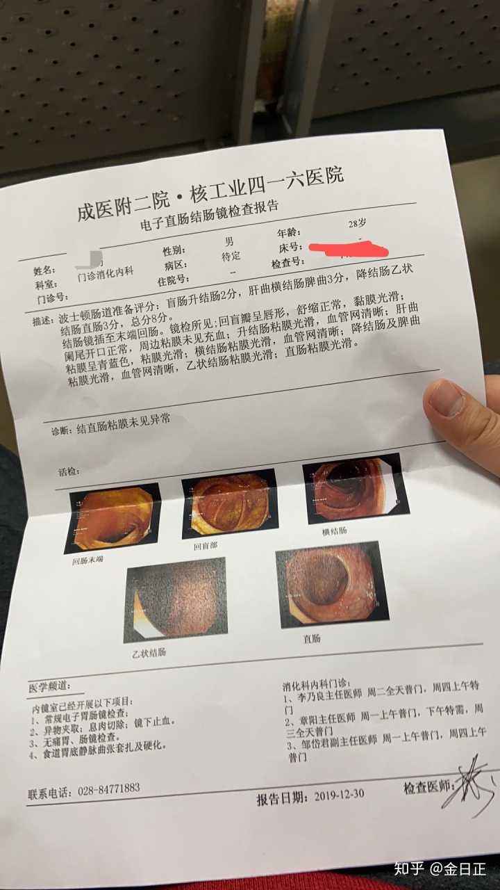 肠镜为什么尽量不要做的简单介绍