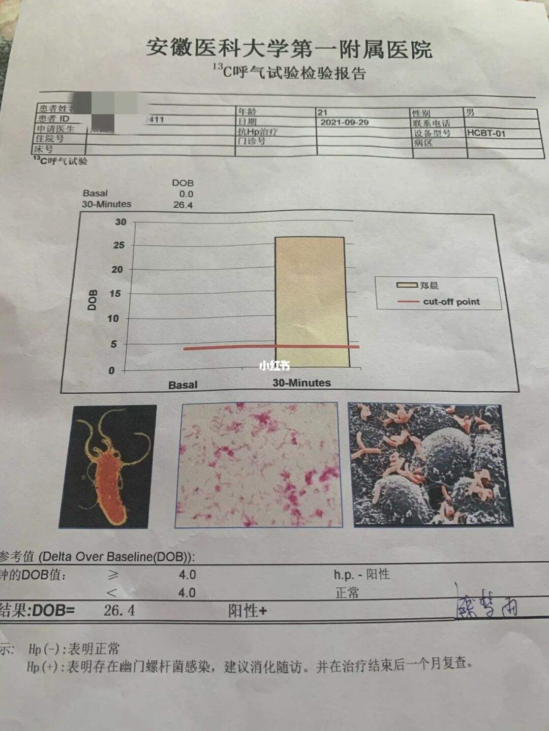 幽门螺旋杆菌需要治疗c14阳性112严重吗