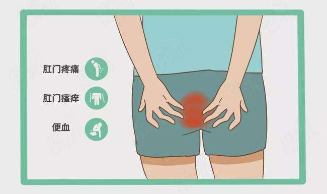 肛裂涂什么药膏能愈合,肛裂出血怎么治愈