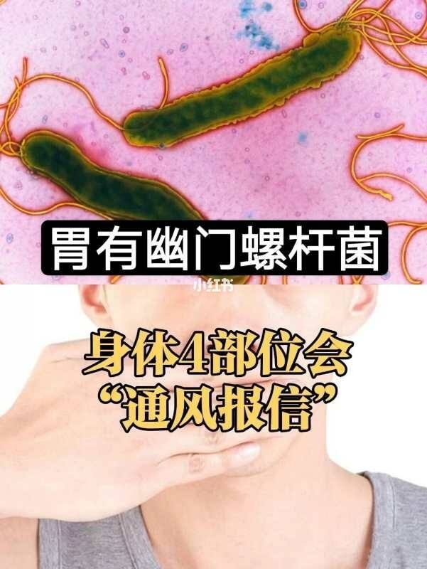 关于幽门螺旋杆菌什么症状啊口臭的信息