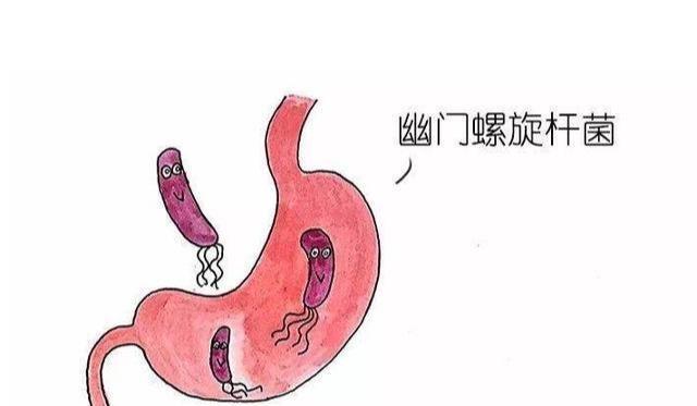 螺旋杆菌是什么原因引起的的简单介绍