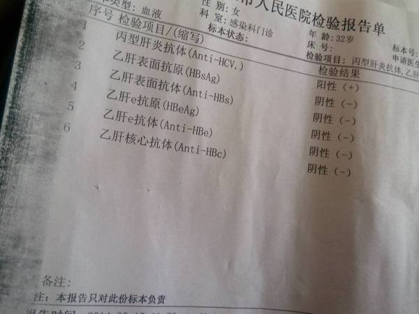 乙肝表面抗体大于1000乙肝抗体阳性