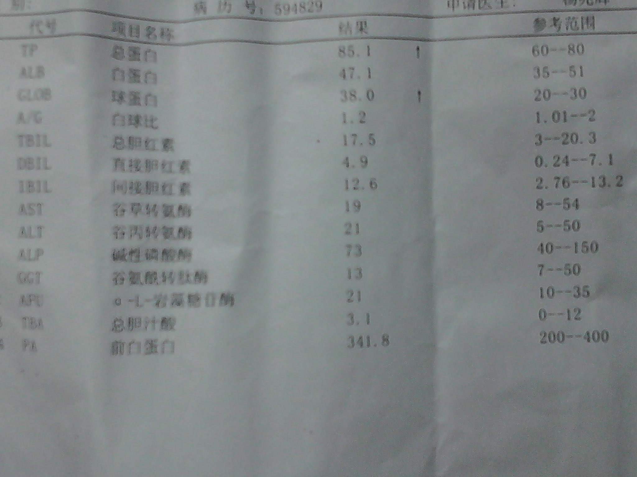 球蛋白偏高怎么降下来,球蛋白高