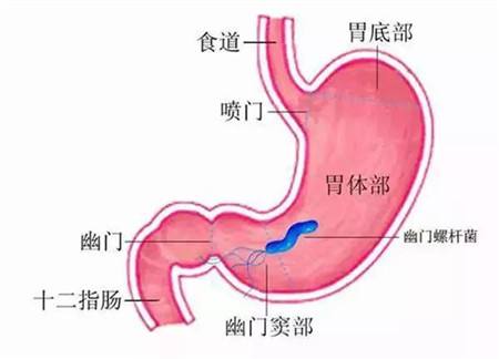 感染幽门螺杆菌什么症状的简单介绍