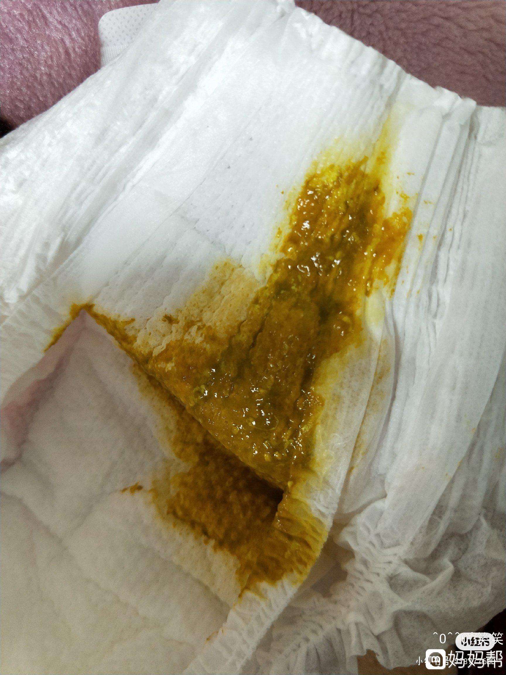 拉稀水,拉屎跟拉水一样还喷射