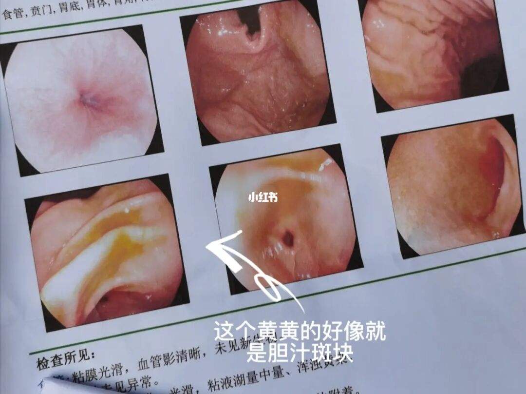 关于胃镜检查需要多少钱一次的信息