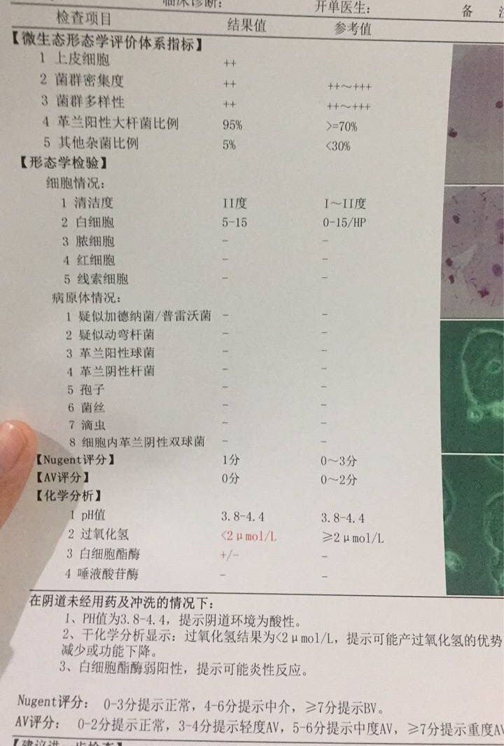 白带清洁度3白带清洁度3能同房吗