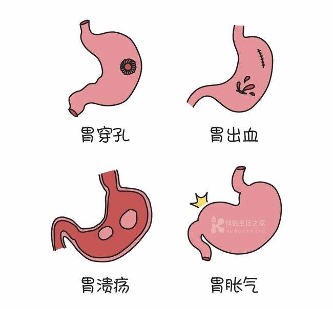 胃癌最明显的一个征兆,胃炎与胃癌自我辨别