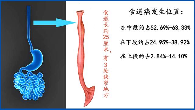 食道癌,食道癌会通过口水传染