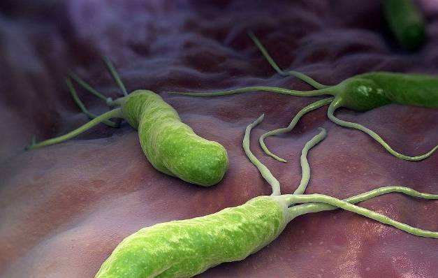 幽旋罗门杆菌有什么症状幽罗门杆菌传染多久才会表现出来