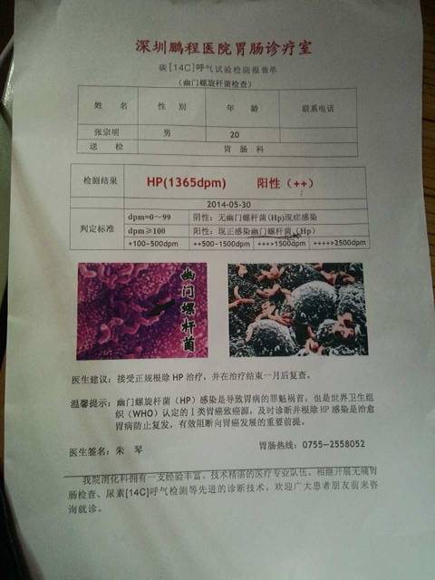 幽门螺旋杆菌检查什么,教你几招自测幽门螺杆菌
