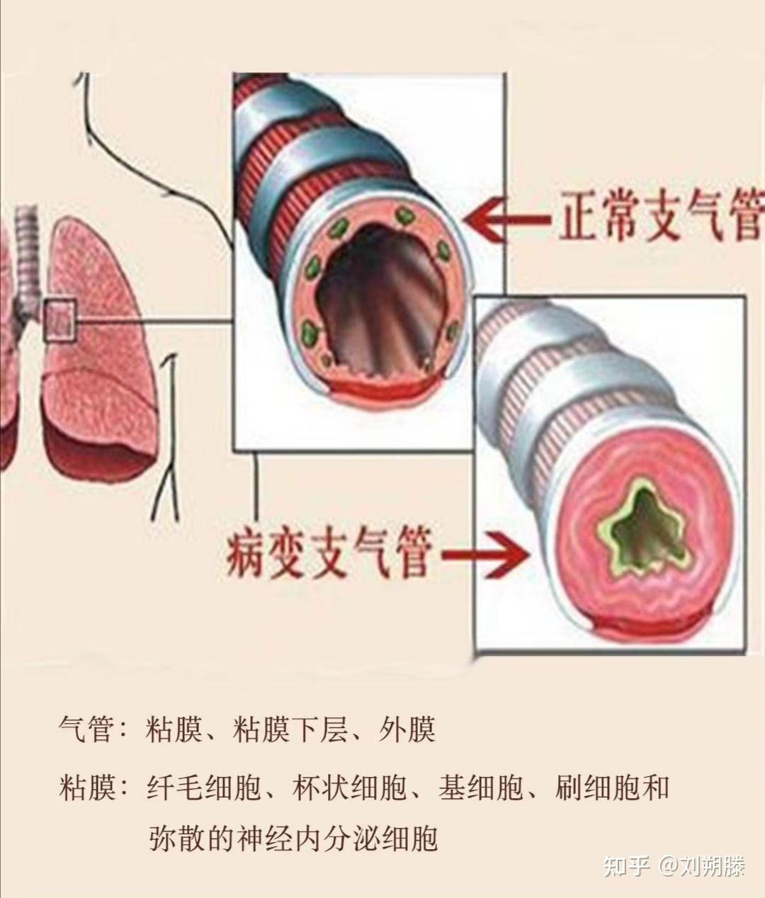 气管气管不好怎么调理