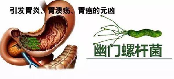 关于江苏启动幽门螺旋杆菌家庭筛查的信息