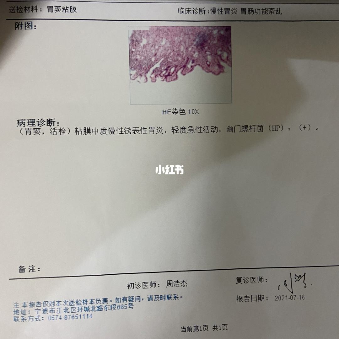 幽门螺旋杆菌值多少正常幽门螺杆菌杆菌正常值是多少