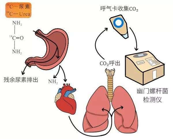 幽门螺旋杆菌的指标范围是多少 幽门螺旋杆菌的指标范围是多少