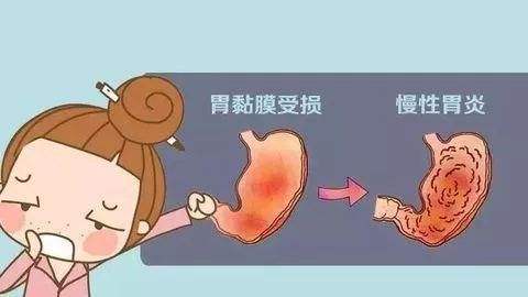 慢性胃炎最多能活几年慢性胃炎症状