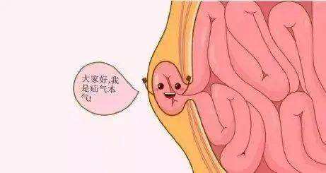 疝气,疝气手术