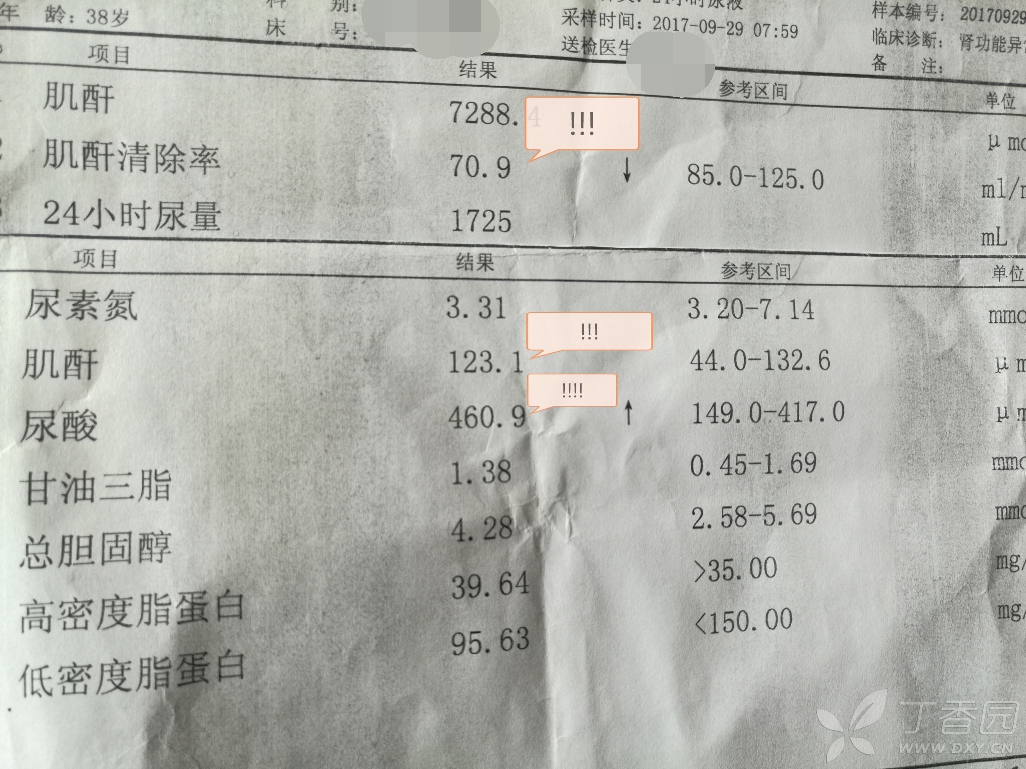 肌酐低是怎么回事的原因,肌酐低说明什么原因