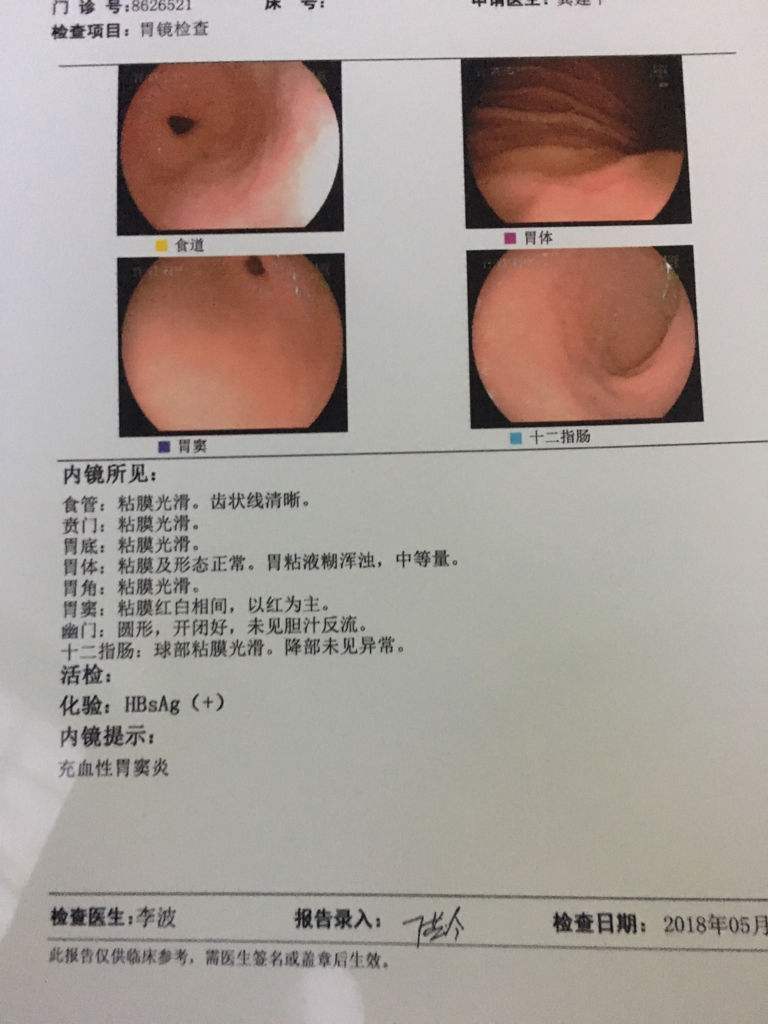 胃镜检查需要多少钱一次,胃镜肠镜检查需要多少钱一次