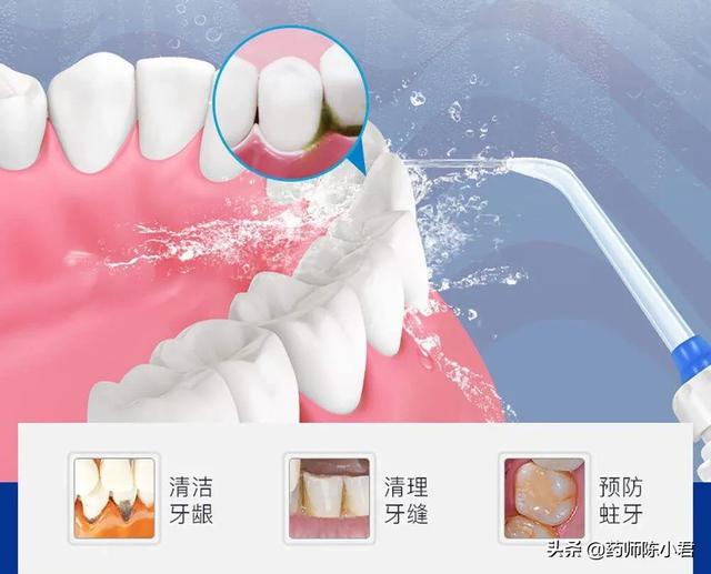 幽门螺旋杆菌阳性可以根治吗 幽门螺旋杆菌阳性可以根治吗