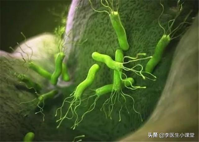 幽门螺旋杆菌感染是怎么引起的 幽门螺旋杆菌感染是怎么引起的