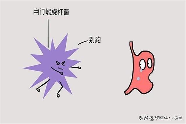 幽门螺旋杆菌感染是怎么引起的 幽门螺旋杆菌感染是怎么引起的