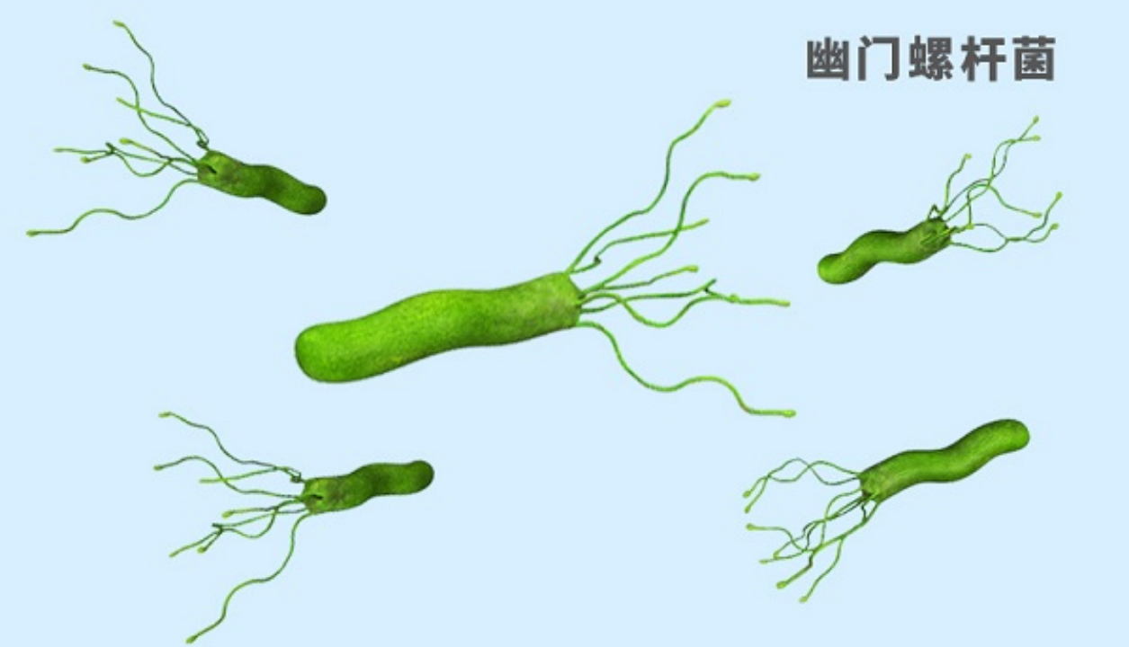 小孩为什么不建议查幽门,幽门螺旋杆菌挂什么科