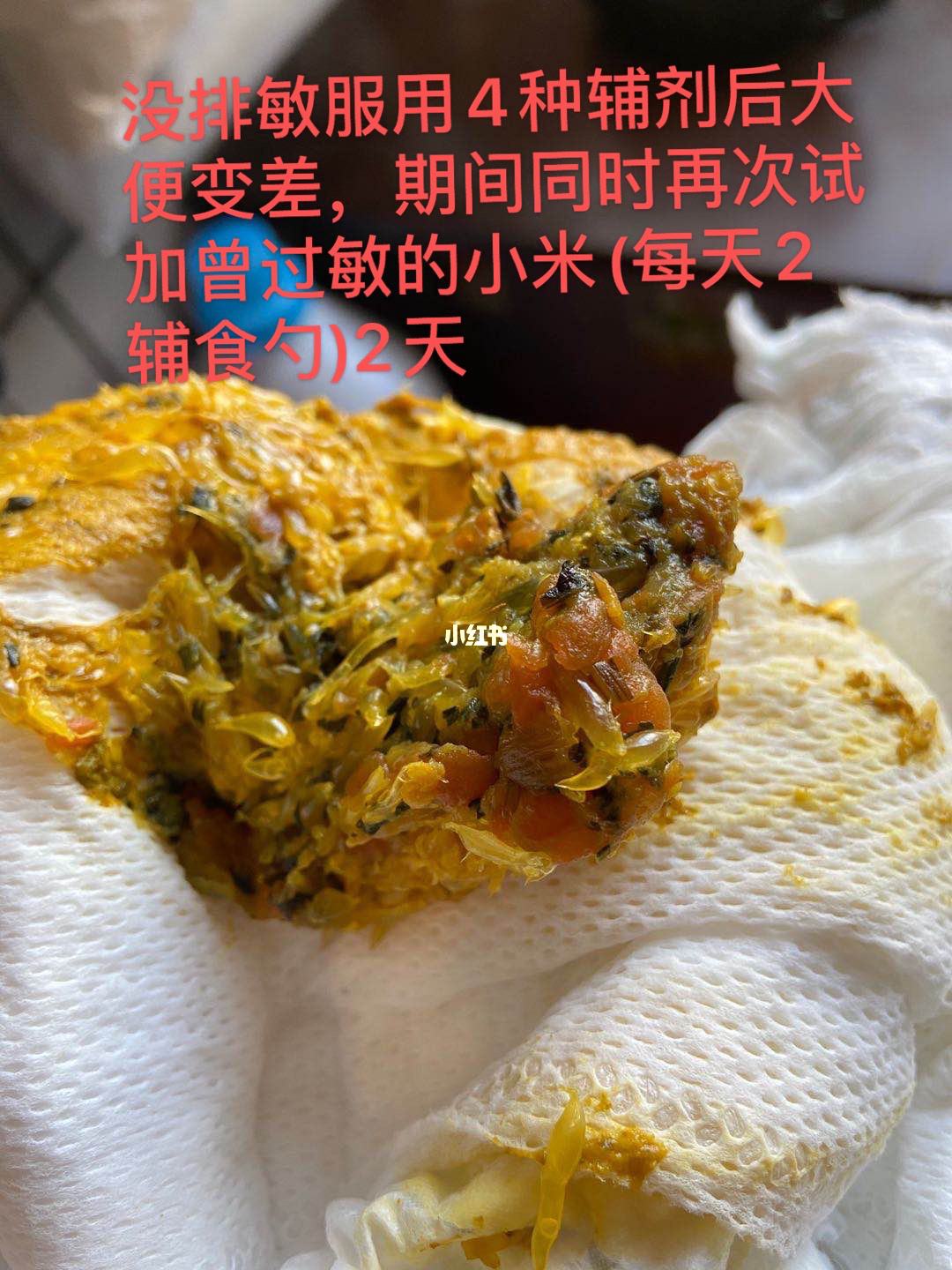 过敏性肠炎小孩过敏性肠炎好冶吗