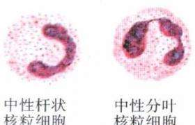 中性粒细胞中性粒细胞绝对值偏高