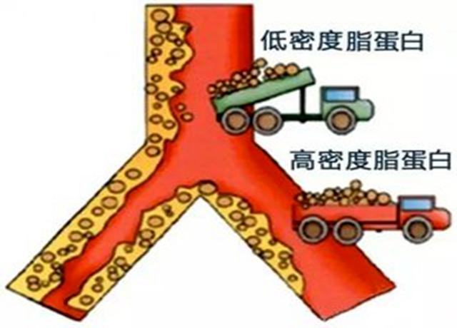 载脂蛋白a偏高血清载脂蛋白a偏高怎么治疗