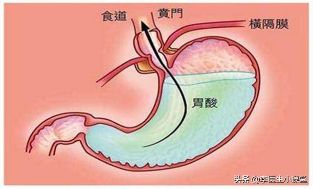 烧心吃什么药 烧心吃什么药