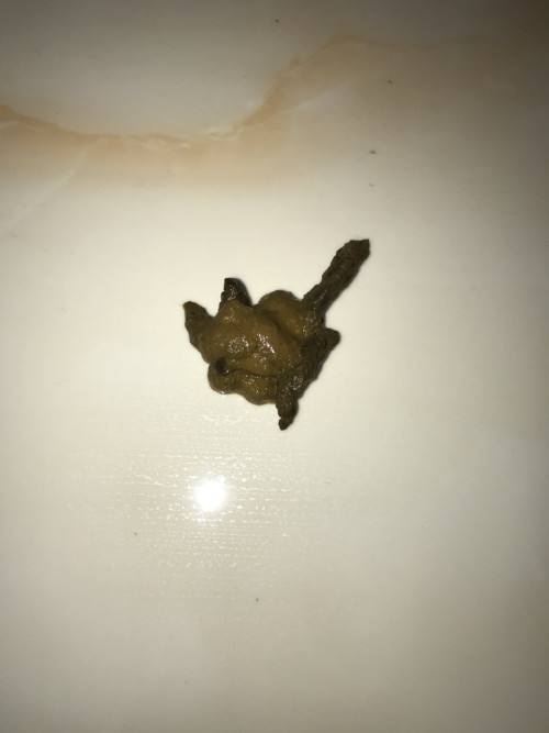 拉肚子拉的全是黄稀水,大便是水状非常危险