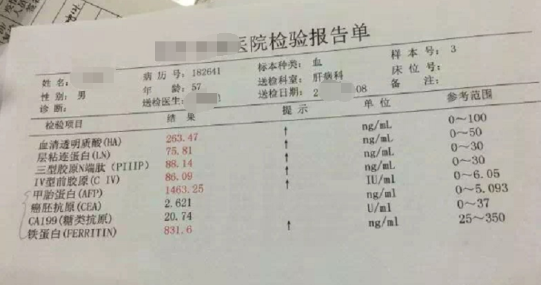 甲胎蛋白224说明什么,甲胎蛋白高说明什么问题