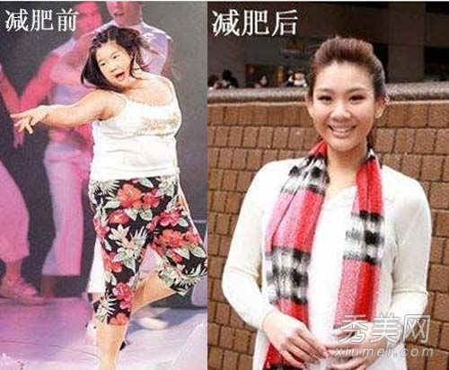 减肥导致脱发能自愈吗减肥后