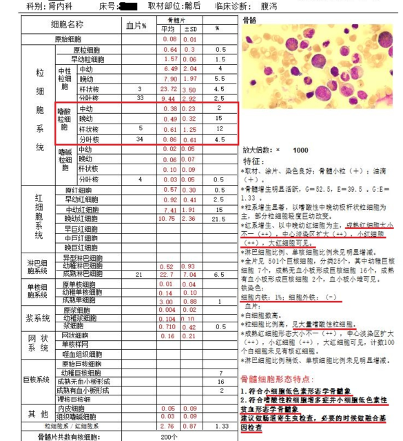 红细胞分布宽度偏低嗜酸性粒细胞偏低