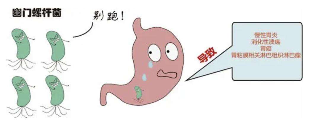 筛查幽门螺旋杆菌是做哪个项目幽门螺旋杆菌阳性++是什么意思