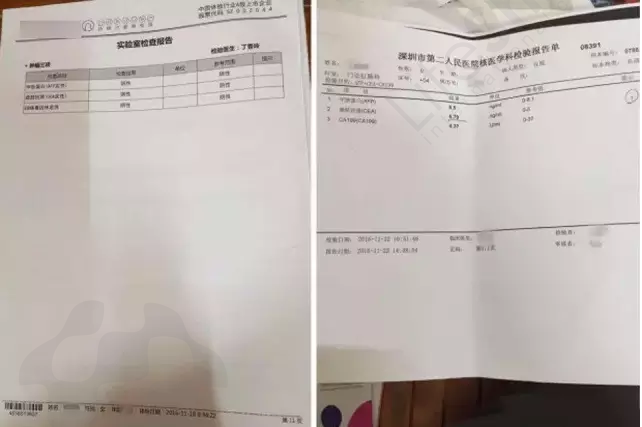 癌胚抗原定量正常值,癌胚抗原定量