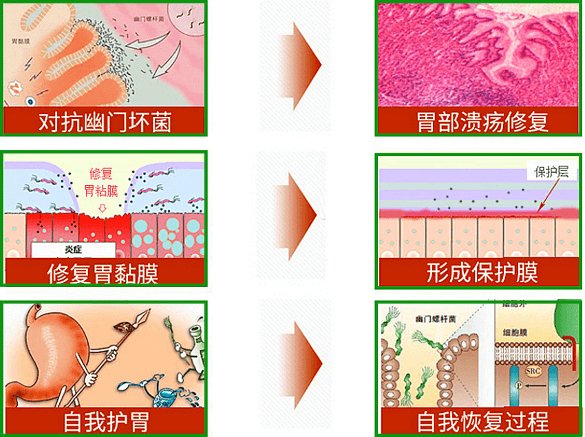 幽门螺杆菌抗体阳性需要治疗吗幽门螺杆菌阳性严重吗要不要治疗