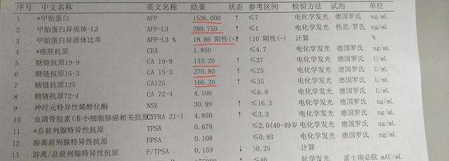 正常人不建议做甲胎蛋白吗甲胎蛋白偏高说明什么