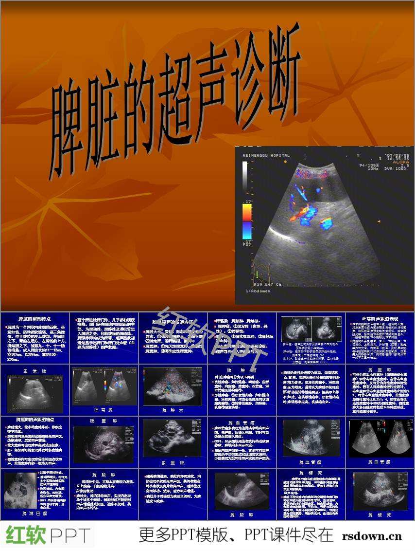 脾痛的症状及治疗方法脾脏疼