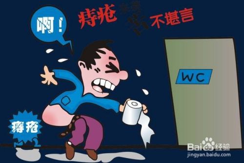 怎么治疗近视,怎么治疗
