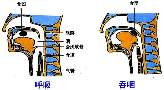 喉癌的早期症状及表现喉