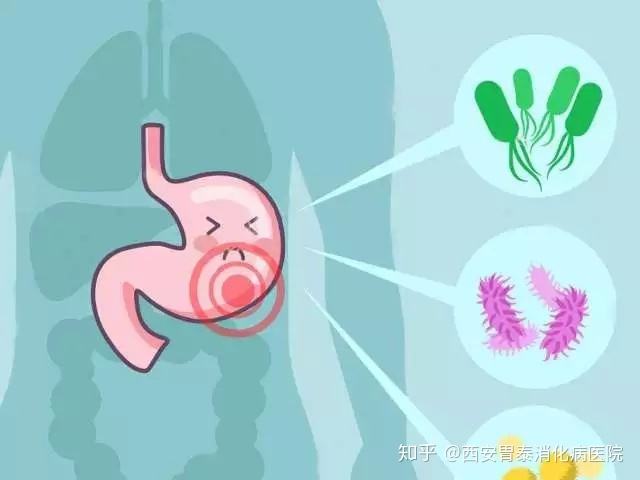 关于幽门螺旋杆菌怎么避免传染家人的信息