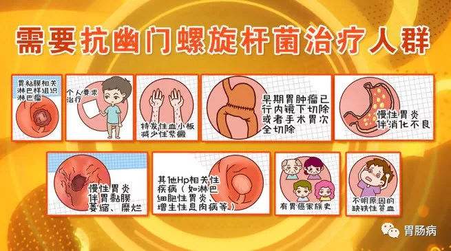 包含幽门螺旋杆菌200阳性需要治疗吗的词条