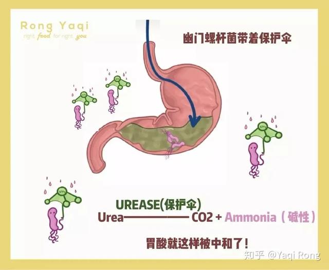 胃酸反流是什么原因造成 胃酸反流是什么原因造成