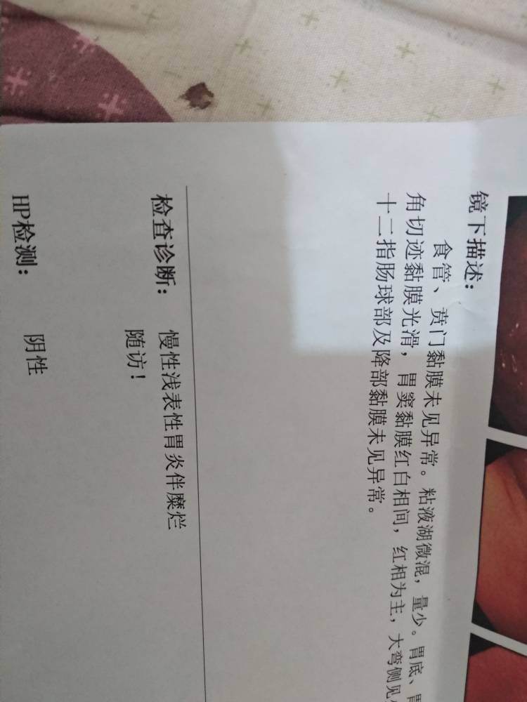 什么叫慢性浅表性胃炎慢性浅表性胃炎