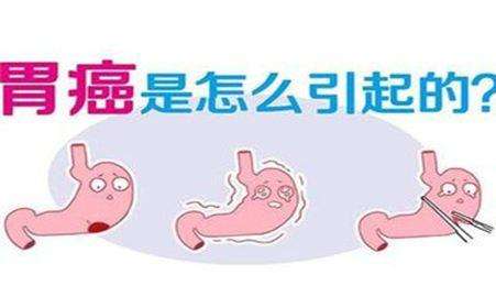 女性胃癌的症状和前兆,胃癌的早期症状