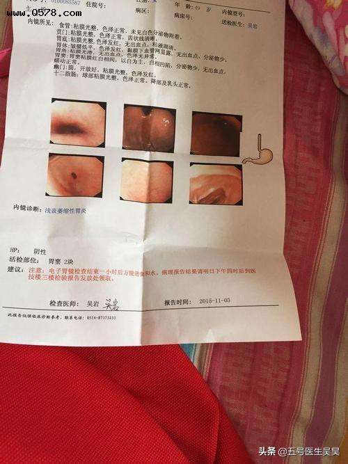 慢性胃炎有哪些症状萎缩胃炎一般能活多久