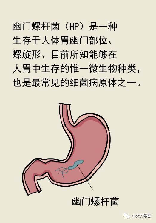 幽门c13476严重嘛,幽门螺旋杆菌感染