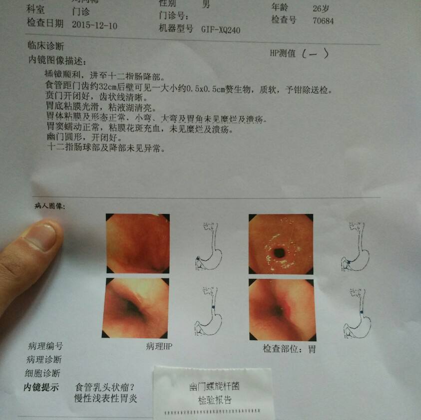 什么是浅表性胃炎严重吗浅表性胃炎怎么治疗